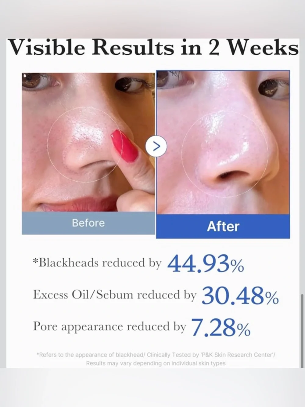 NEW Medicube Zero Pore Pad - White Jar with Blue Lid
